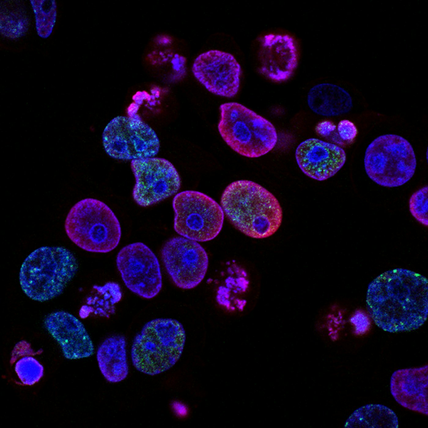 Fluorescence microscopy image of labelled cells