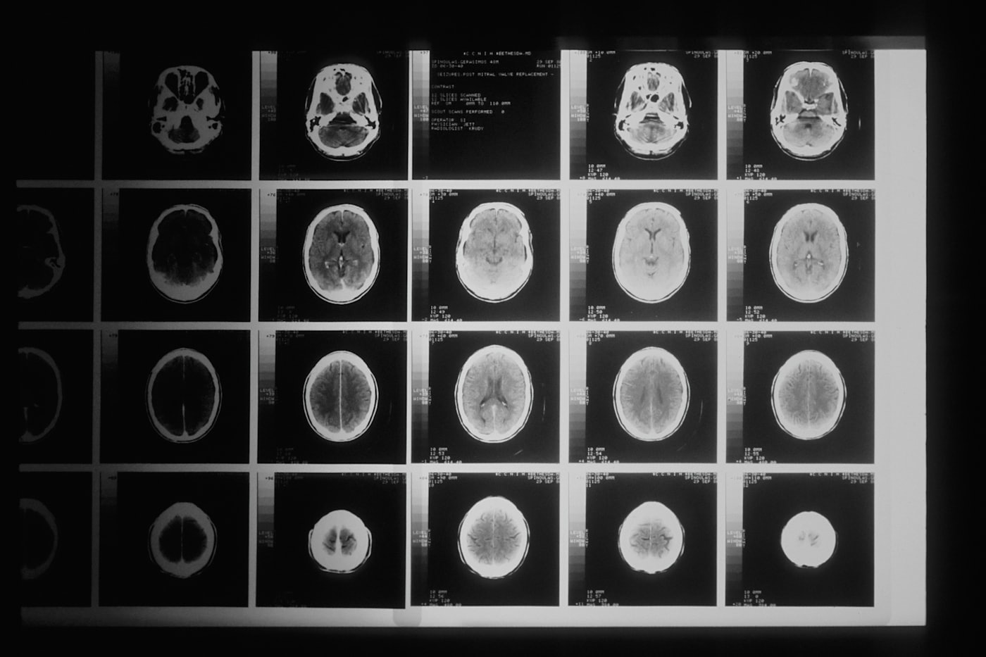 Grid of brain scan images